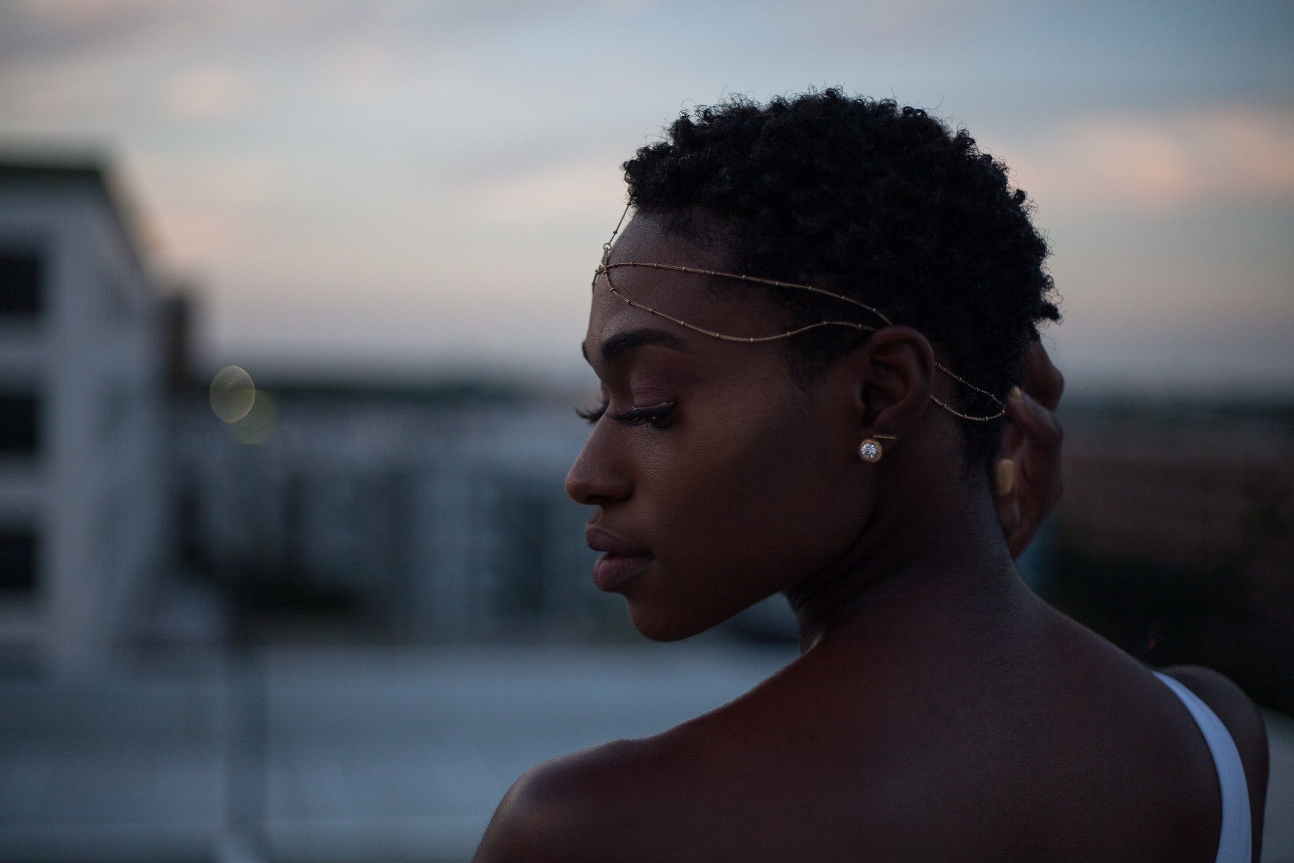 Discoid Lupus on Black Skin: Signs, Scalp Hair Loss and Treatment
