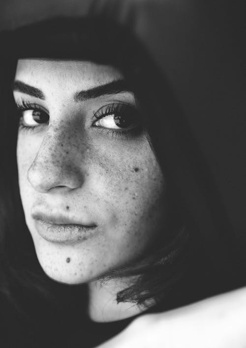 A black and white photo of a woman with freckles