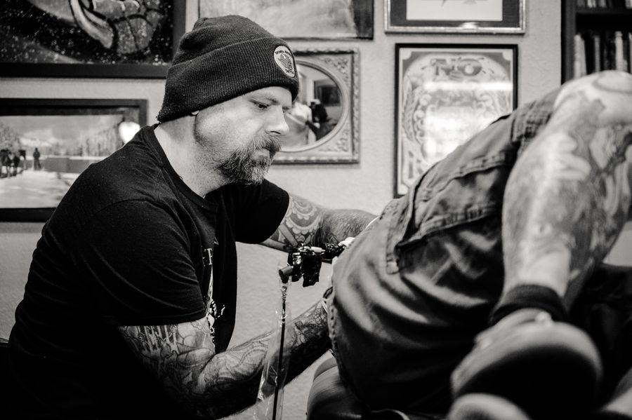Tattoo Removal