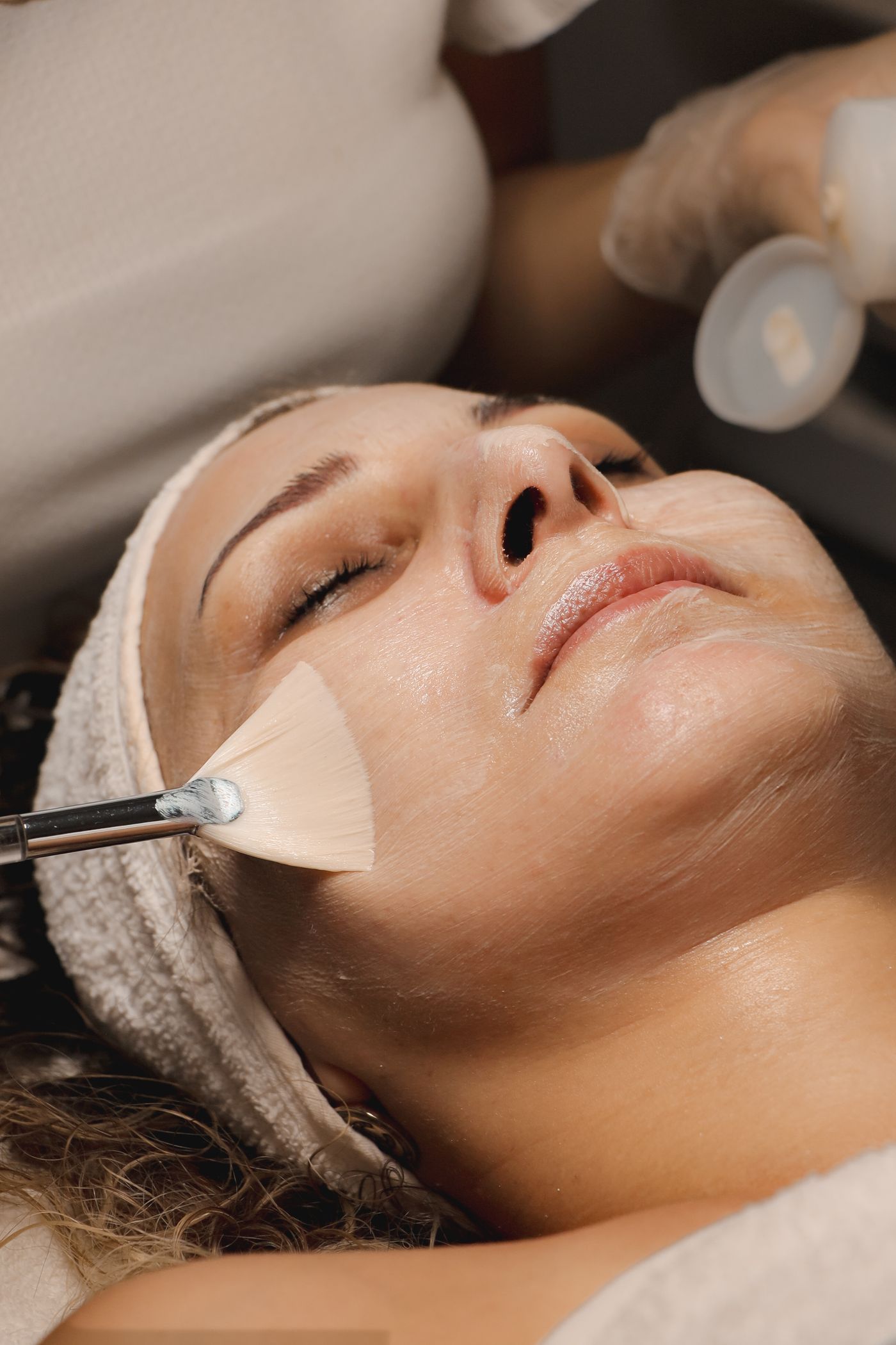 Chemical peel solution being applied during a treatment in Franklin Square NY