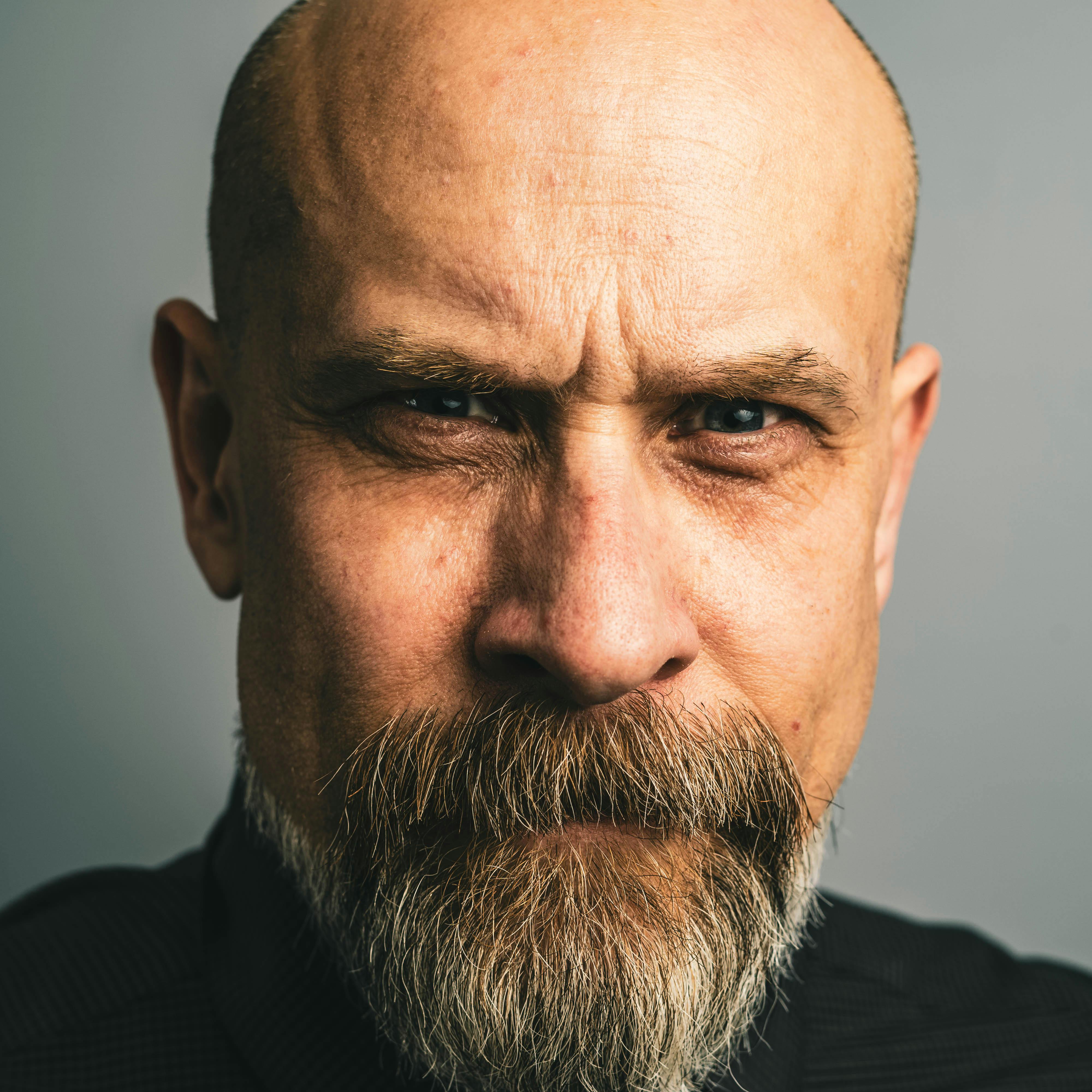 Bald man with a serious facial expression. | Photo: Pexels