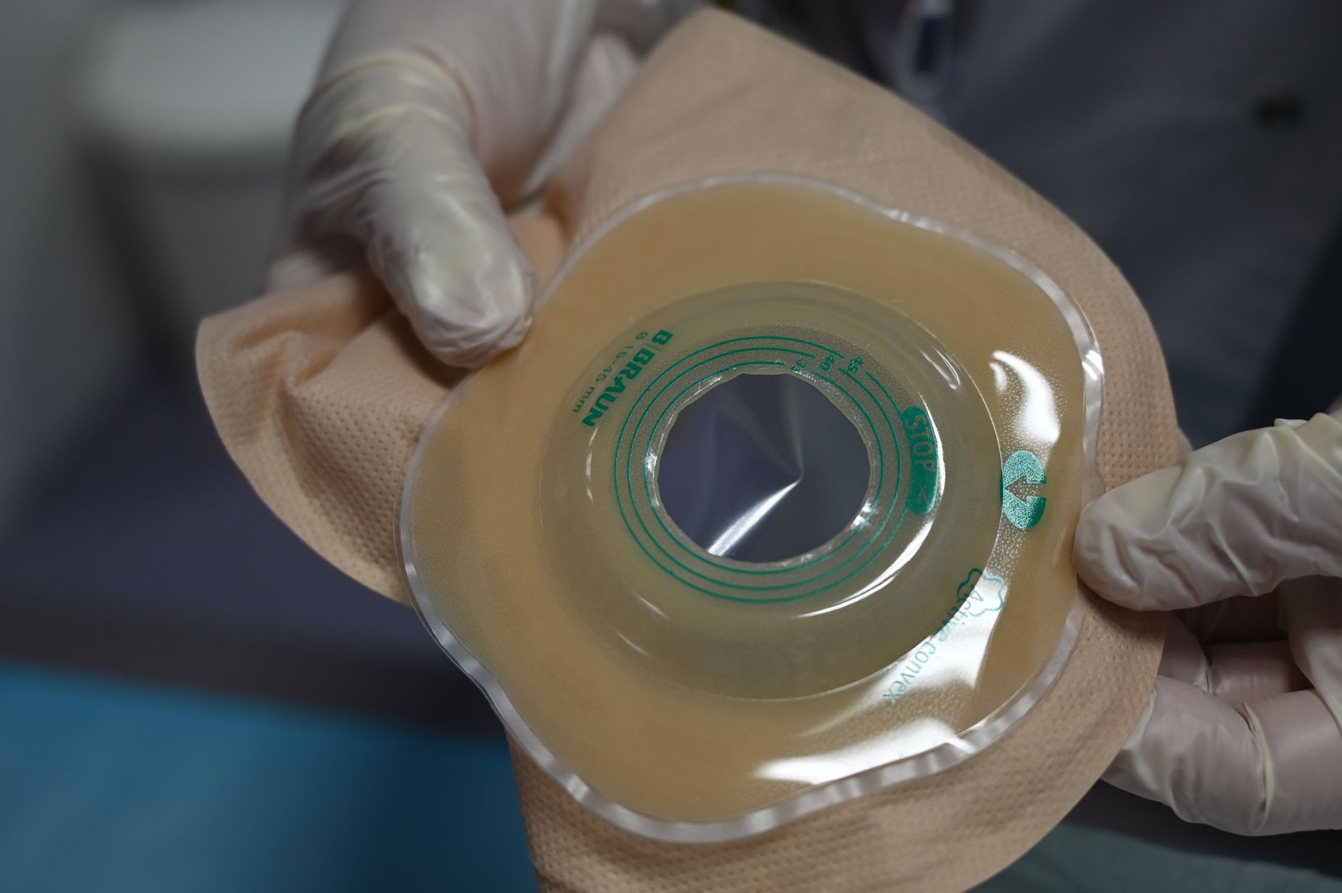 How To Choose Free Ostomy Bags Your Essential Guide To Support And Resources