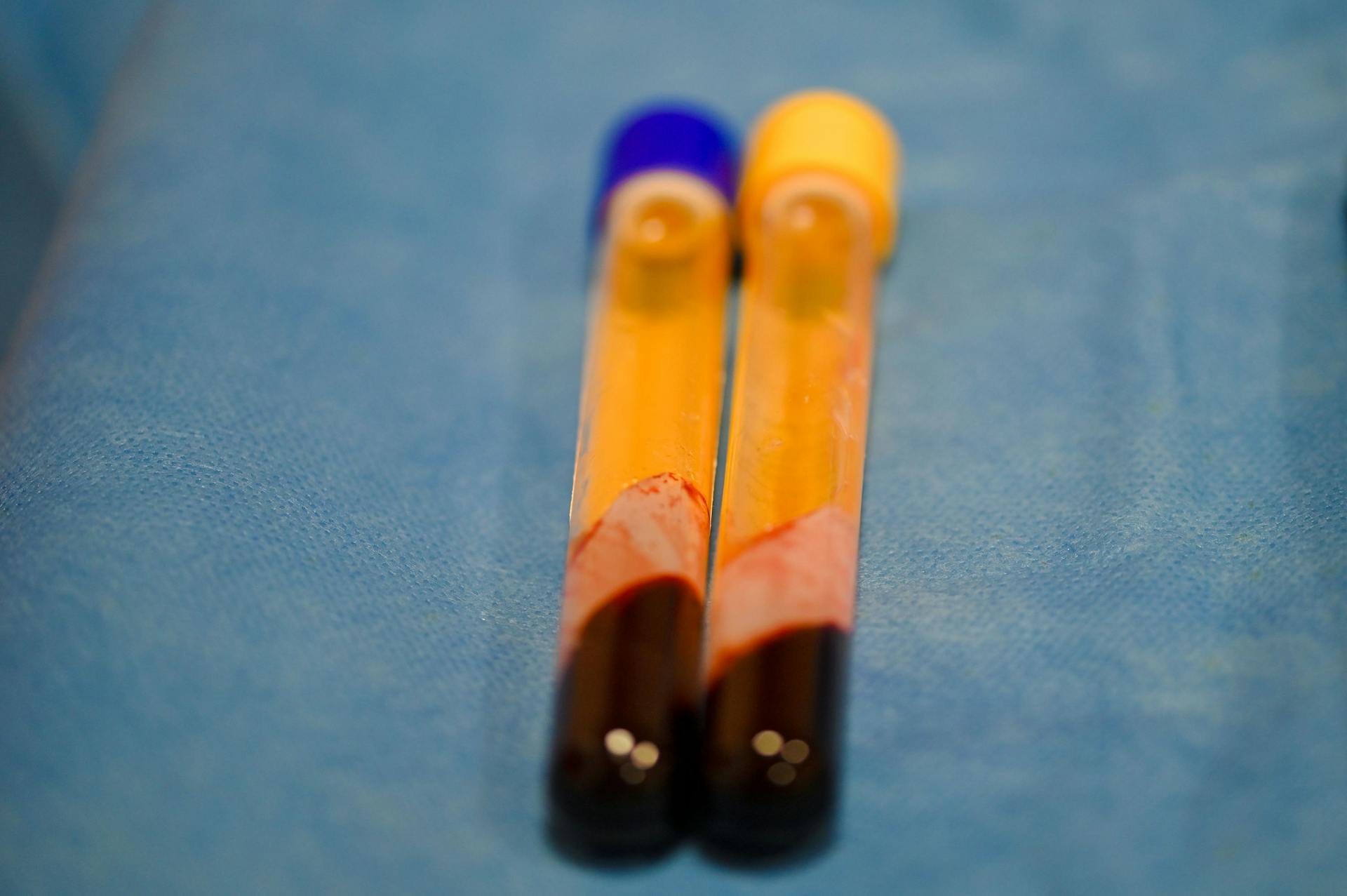 Blood Samples In Vials