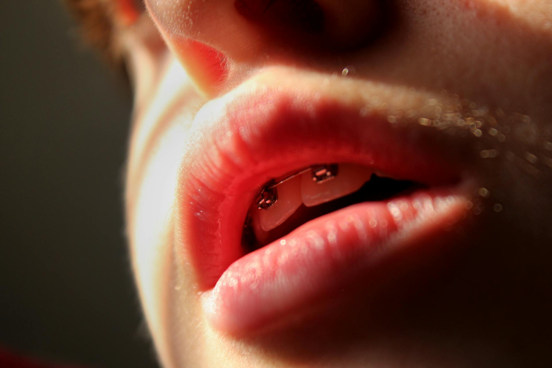 Intimate close-up shot of a teenager's lips and braces in soft lighting.