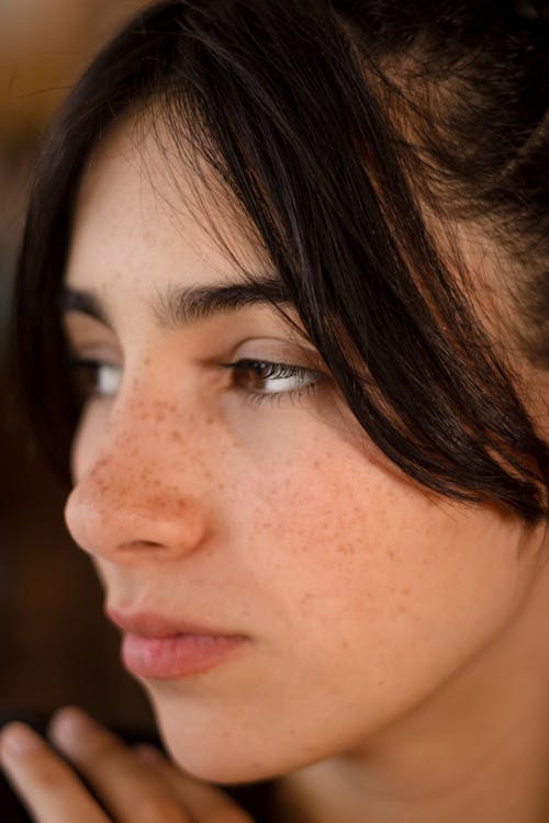 A woman with freckles on her face