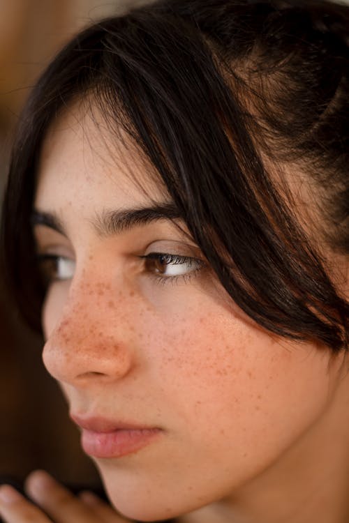 A woman with freckles on her face