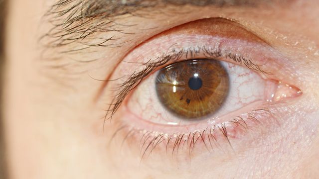 Micropigmentação de Olhos em Campinas: Entenda os Riscos e Como Prevenir - Augusta Perfection