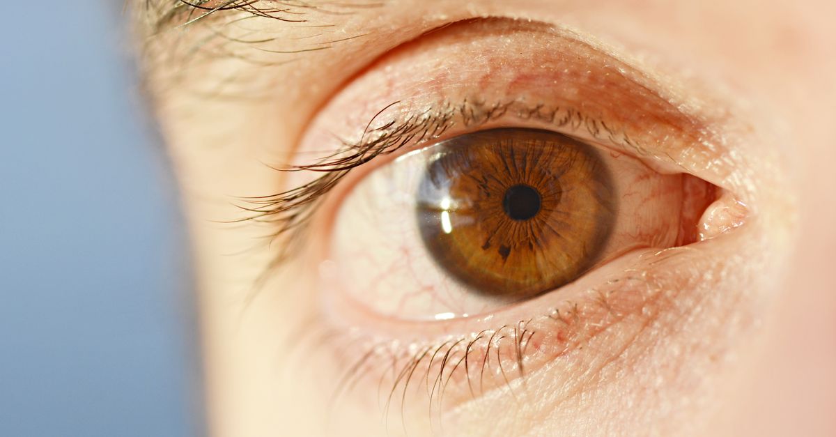 AIIMS Expands Cornea Retrieval Network with Three New Hospitals