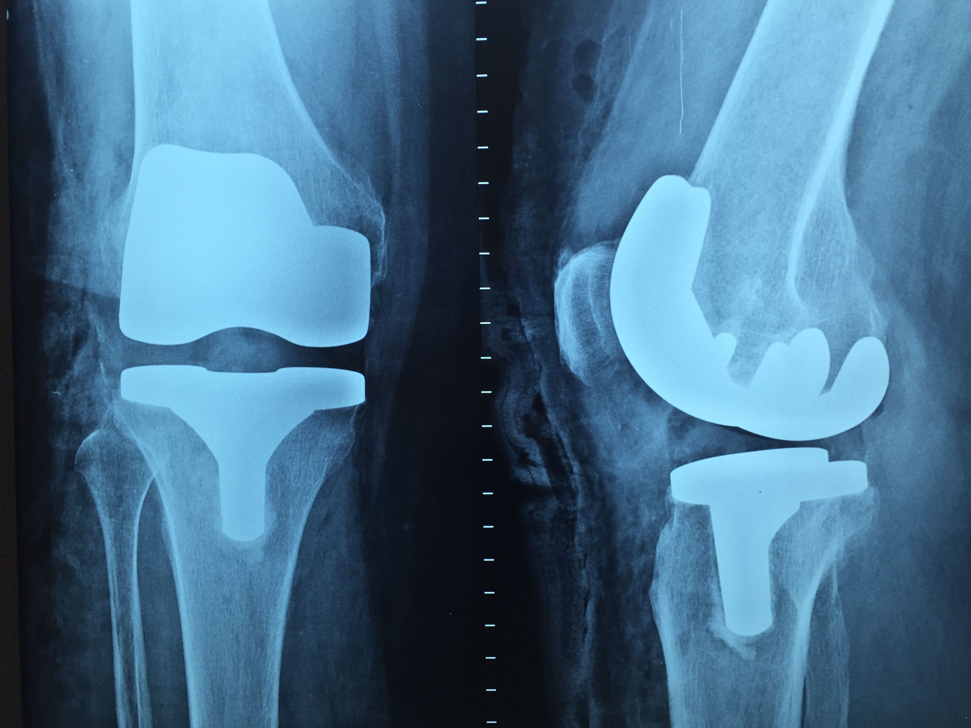 free stock photo of doctor knee orthopedics photo of doctor knee orthopedics
