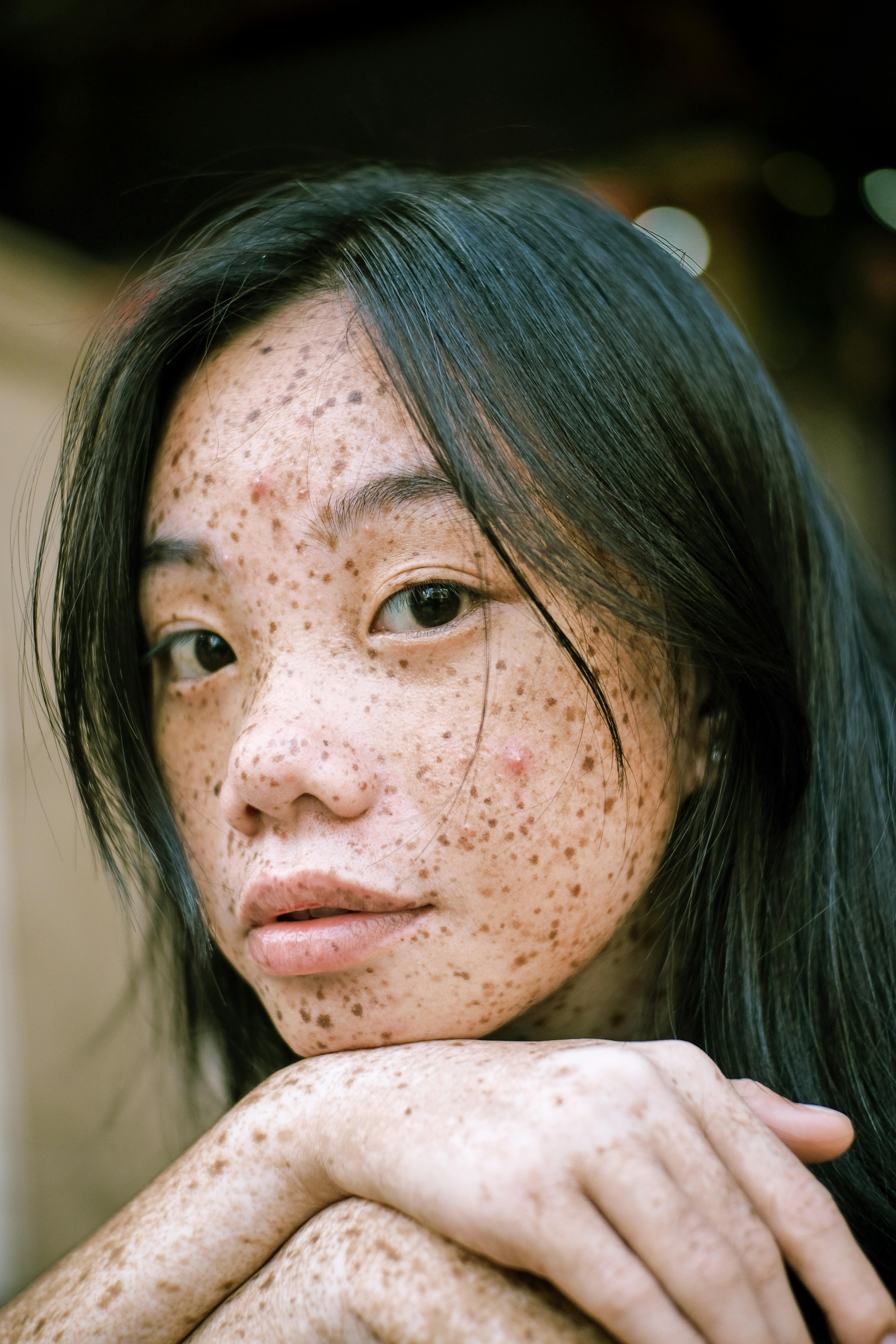 close up photography of woman s face with freckles