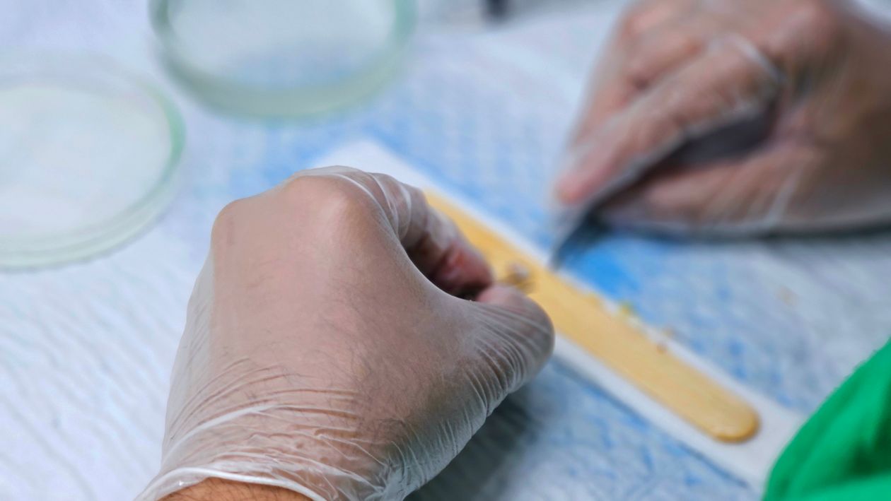 Free Detailed view of hair graft preparation during a hair transplant surgery. Stock Photo