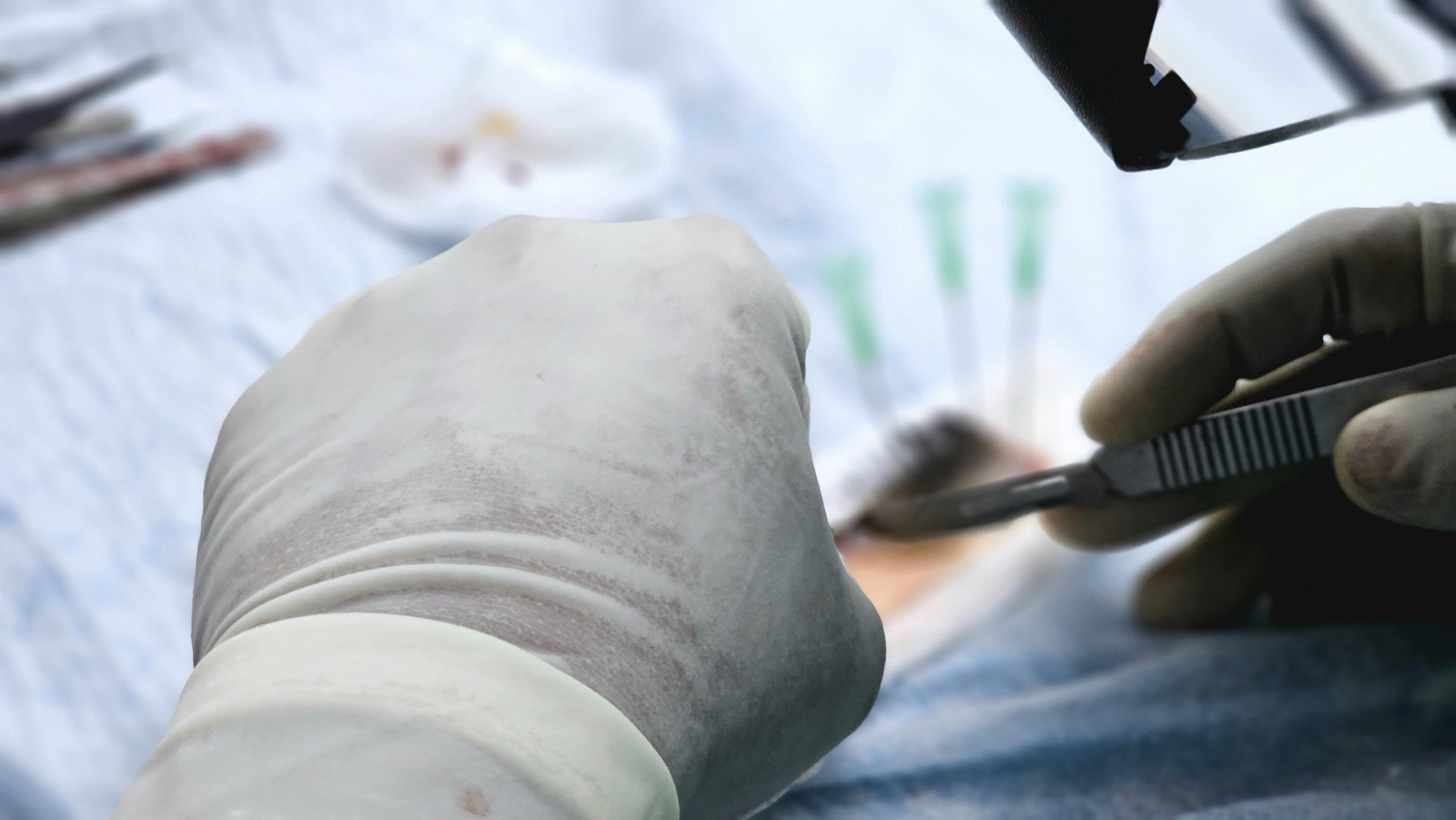 close up of a doctor wearing gloves holding a medical instrument