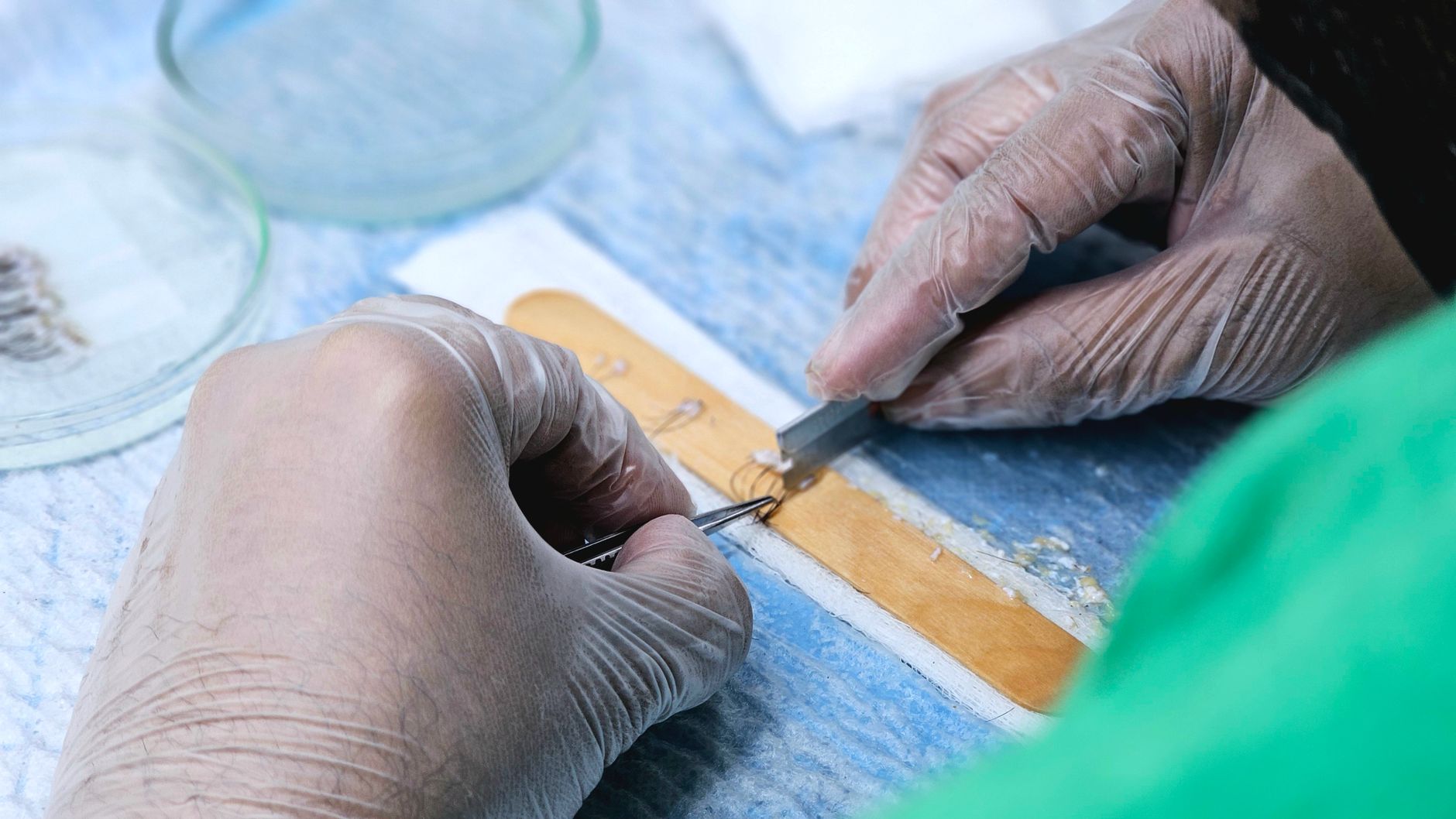 Discover The Hair Restoration Clinics Near You
