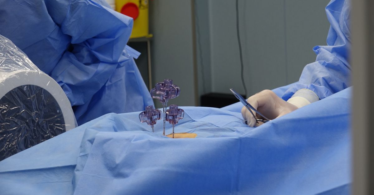 Pioneering Organ Transplant Technique Aims to Eliminate Anti-Rejection Drugs