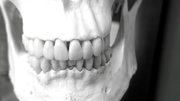 A Skull with Teeth