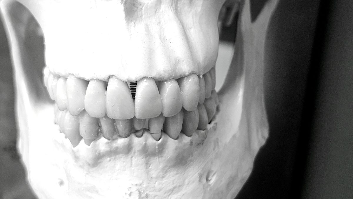 Canine Teeth Age Chart Track Your Dog's Development Stages