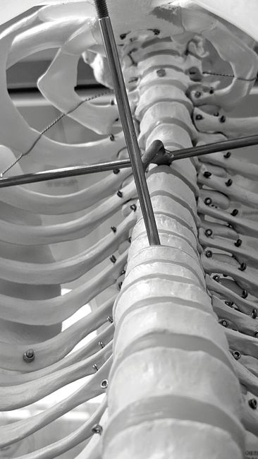 Intricate black and white photo of a human rib cage model with metal rods and wires