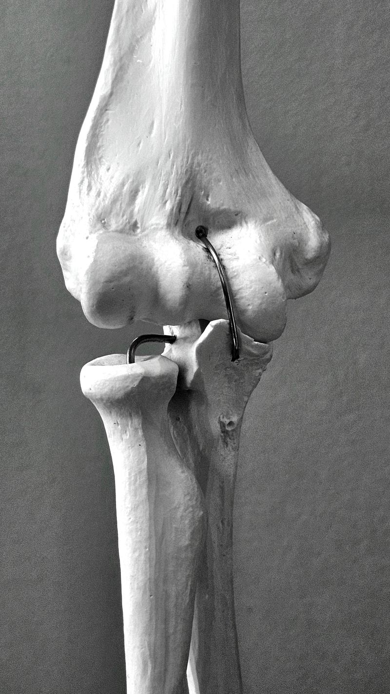 A detailed view of the human knee joint anatomical model
