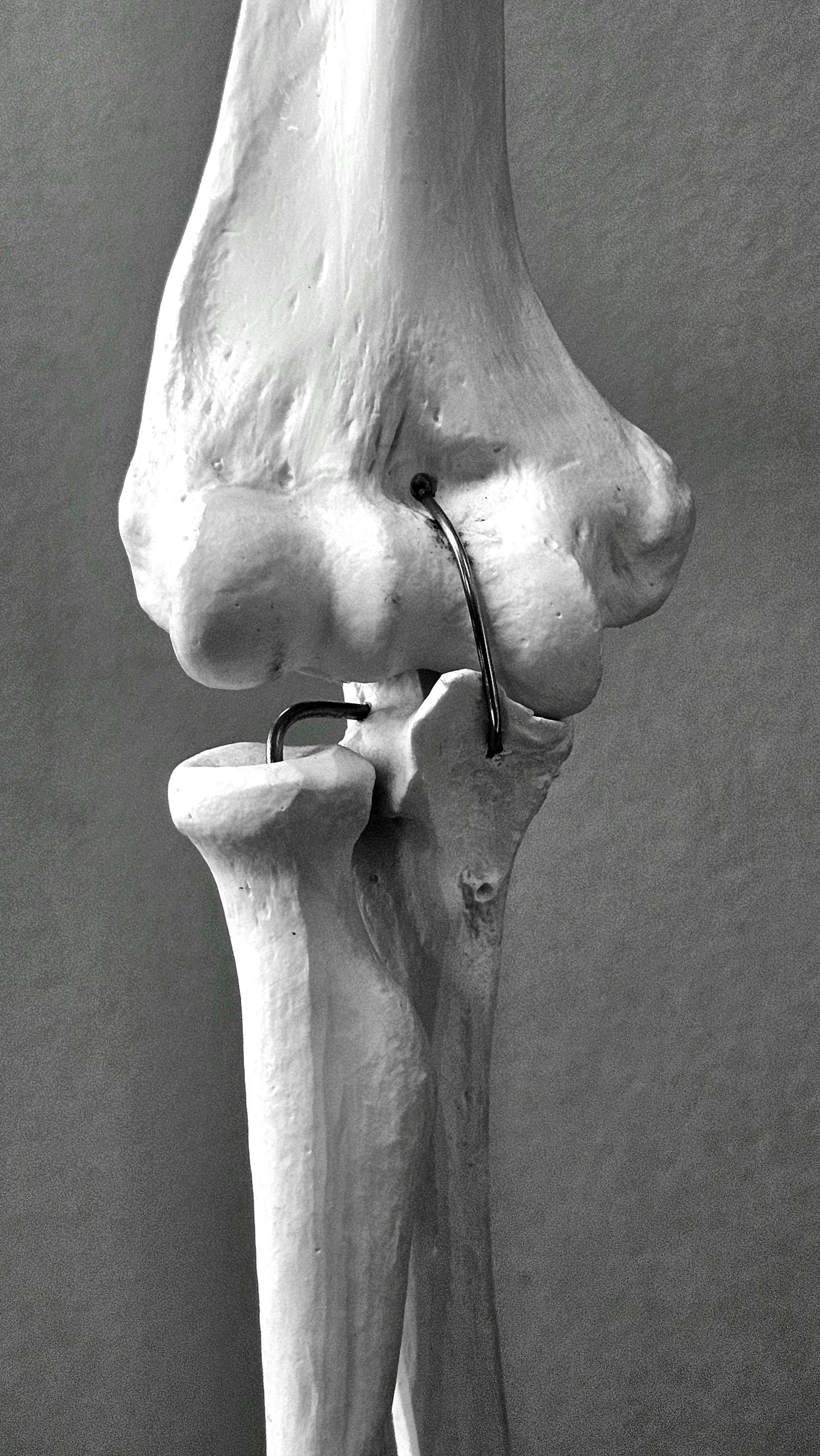 Bezpłatne Darmowe zdjęcie z galerii z anatomia, anatomia człowieka, badanie anatomiczne Zdjęcie z galerii