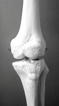 bone