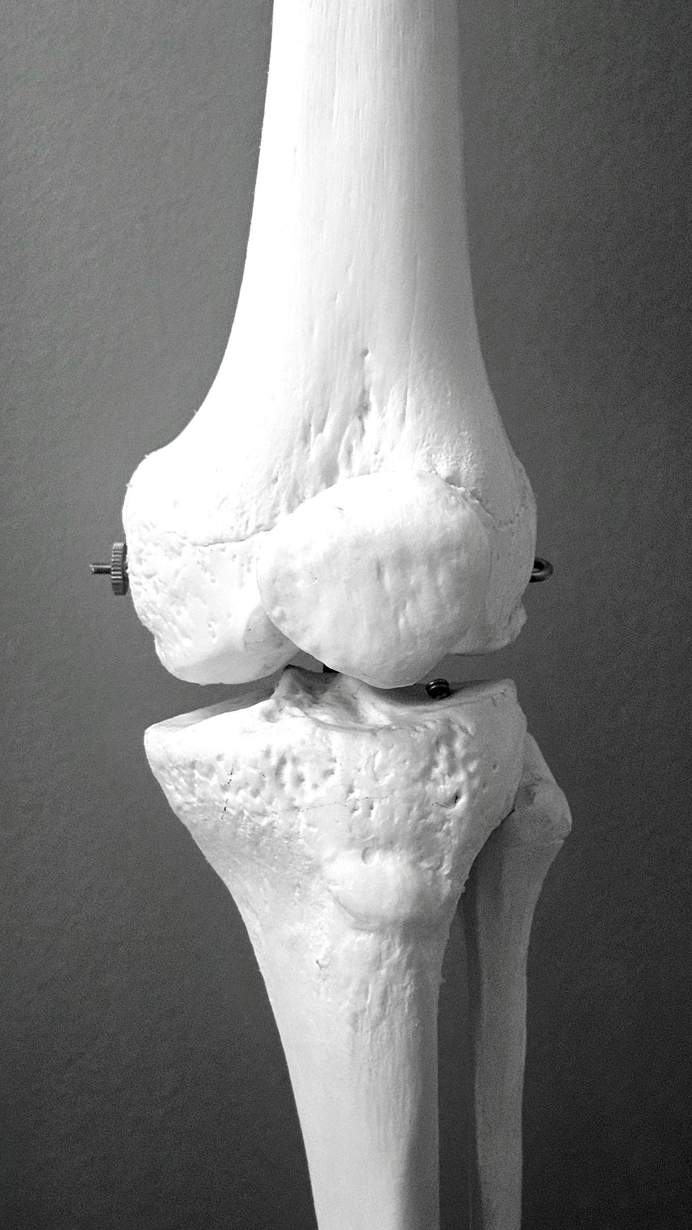Joint anatomy model, why this problem exists