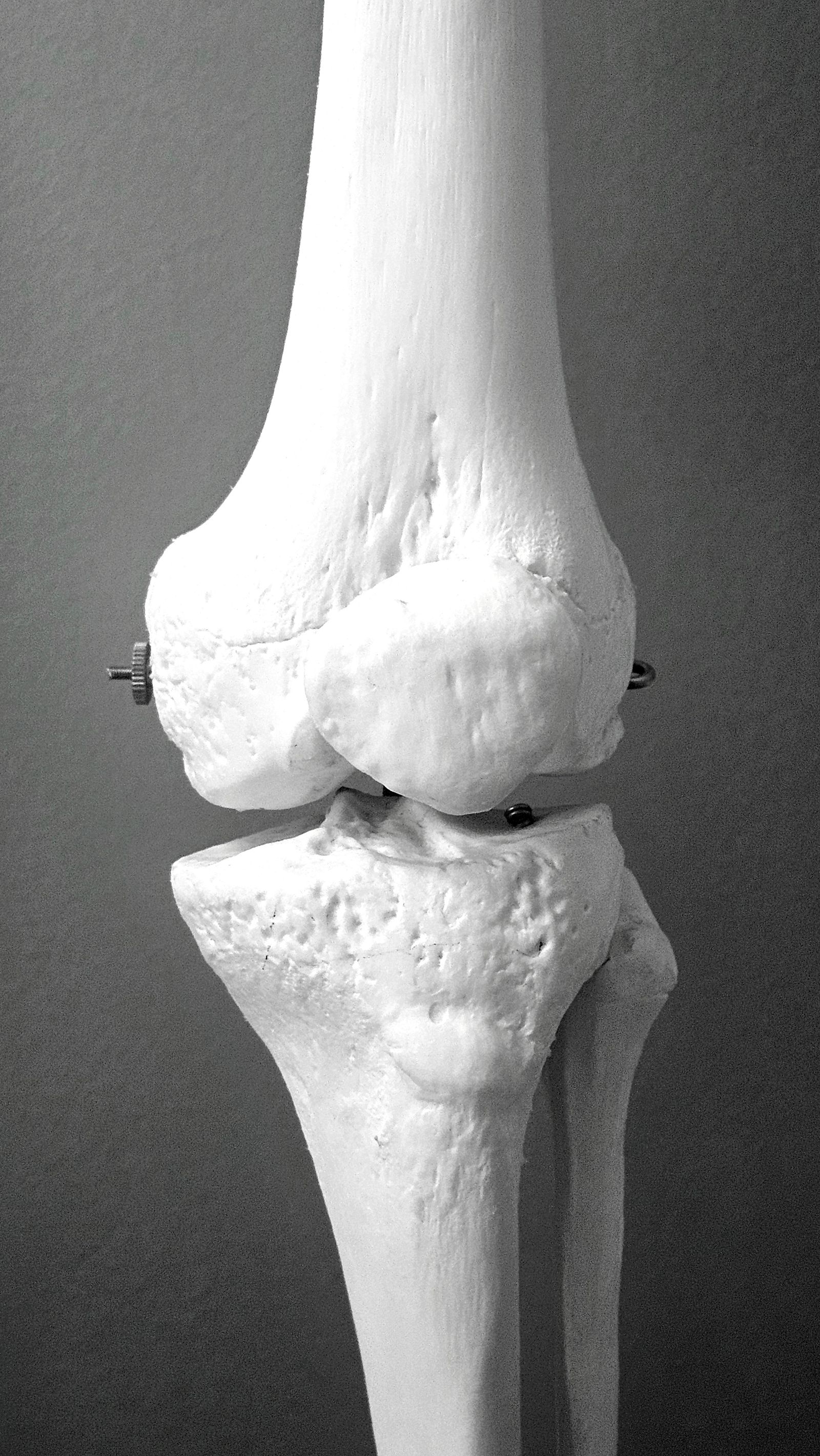 Scientific research on collagen and joint health
