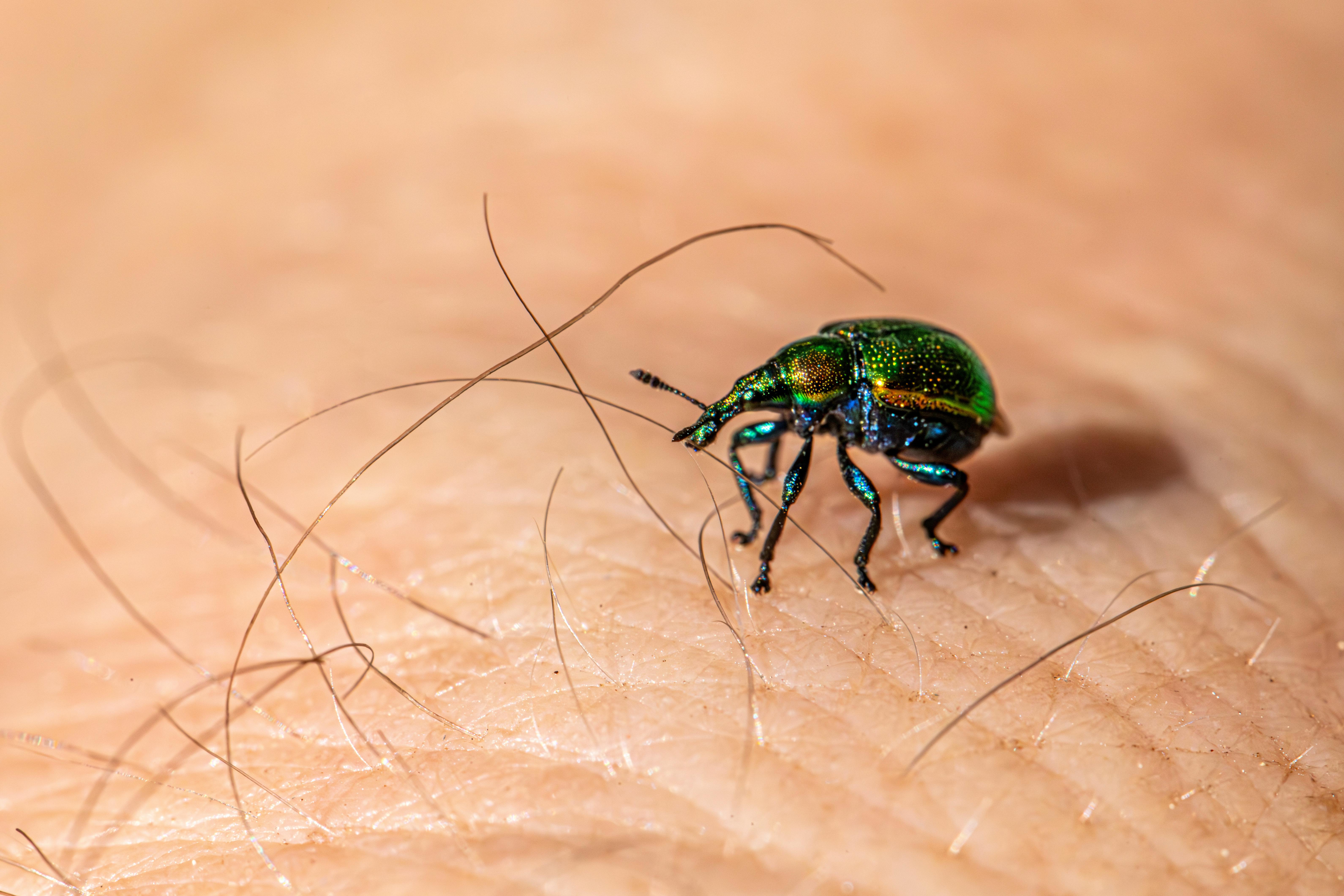 A green and blue beetle on a person's skin