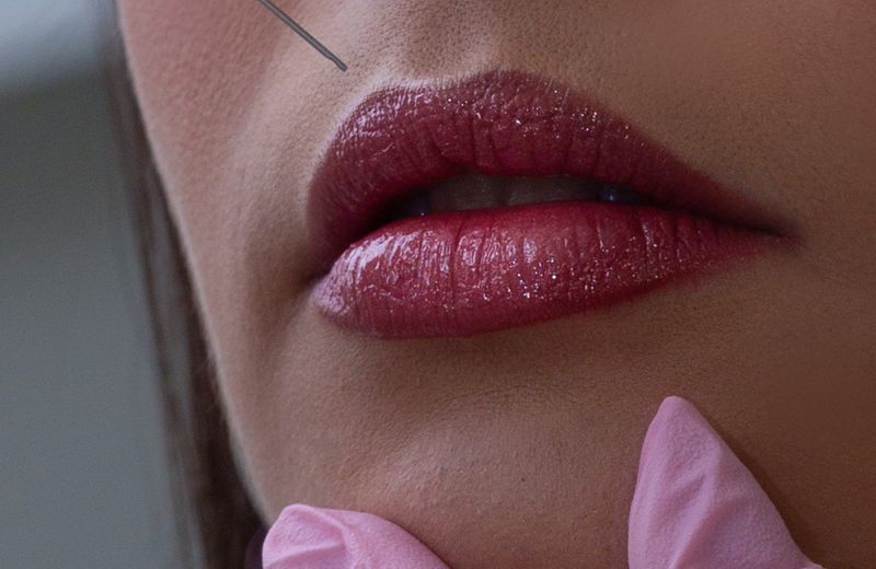 Fillers at Derma Skin and Hair Solutions