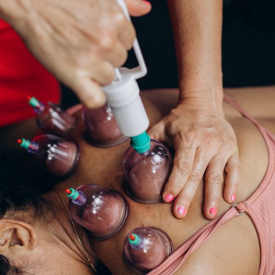 Cupping over worked muscle