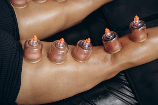 Close-up of cupping therapy on legs, highlighting natural healing and recovery benefits.