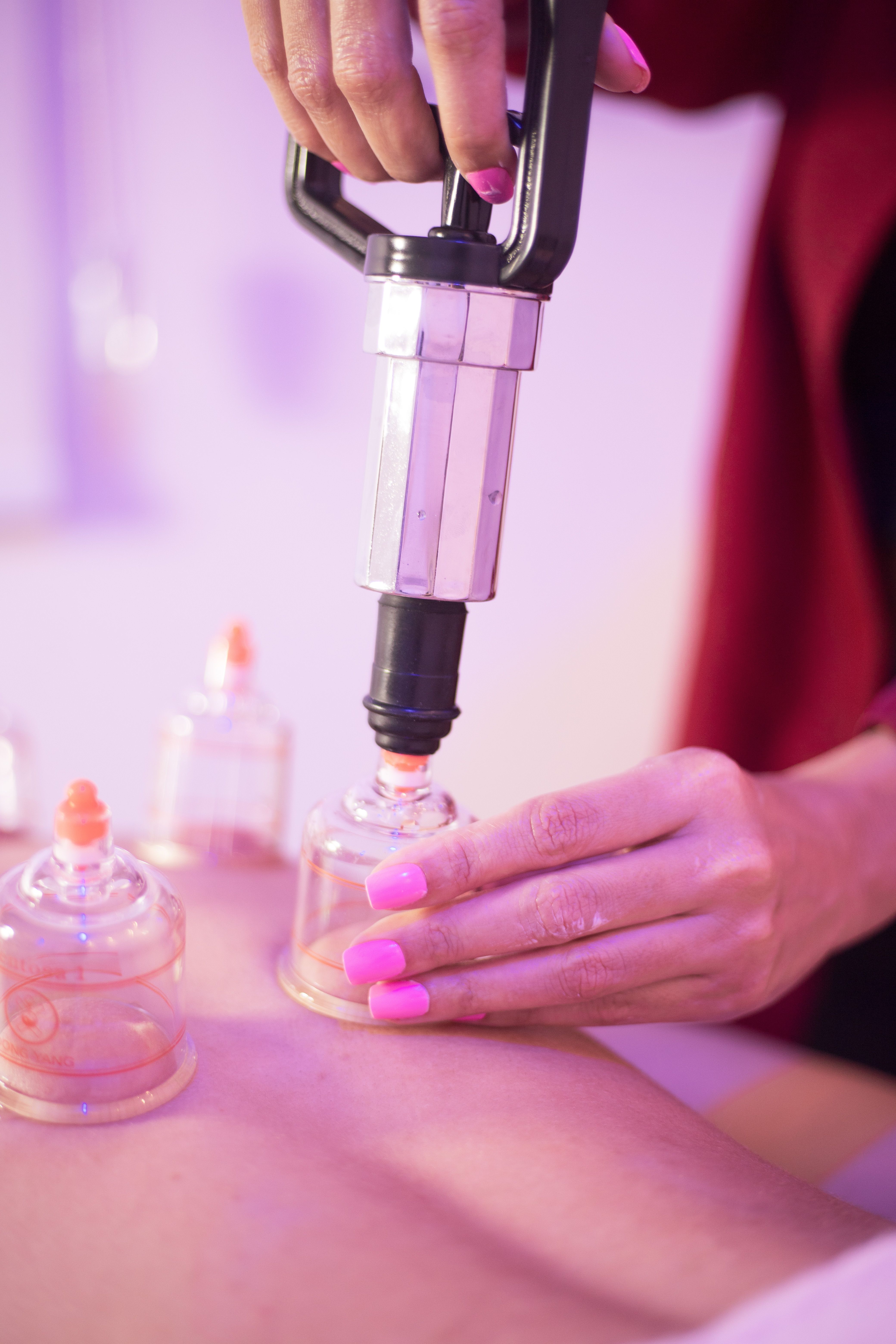 Cupping therapy treatment