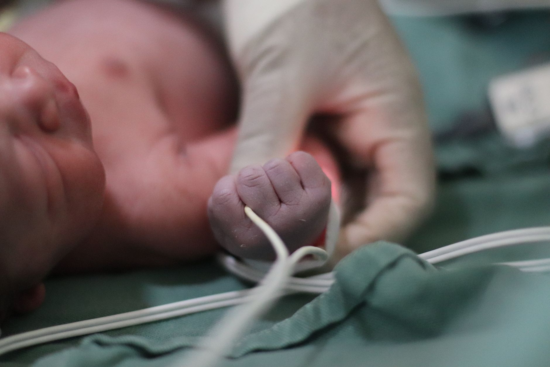 TENS Machine for Labor Pain: A Natural Approach to Comfort