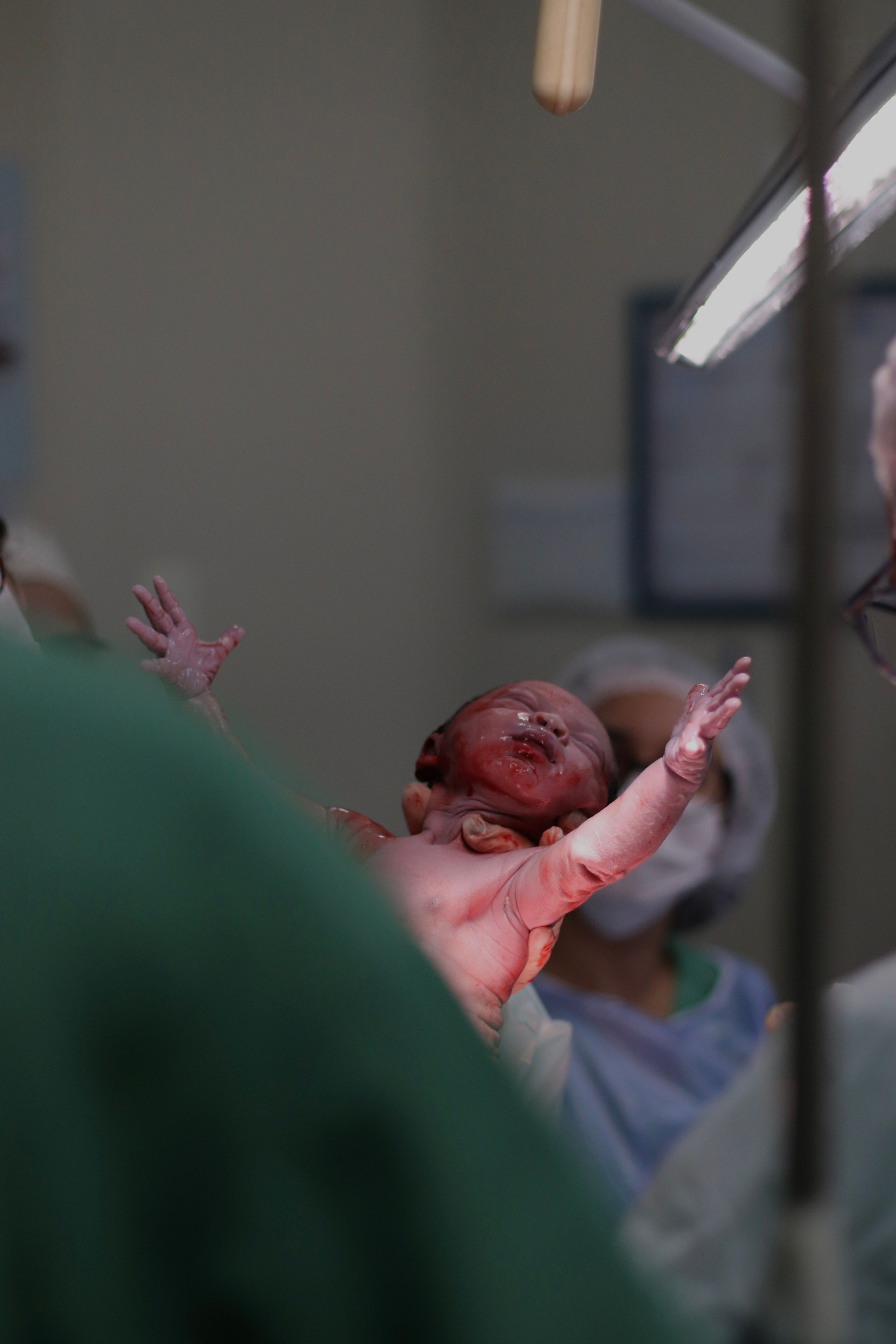 A newborn baby is held in a hospital operating room during birth, highlighting healthcare scene.