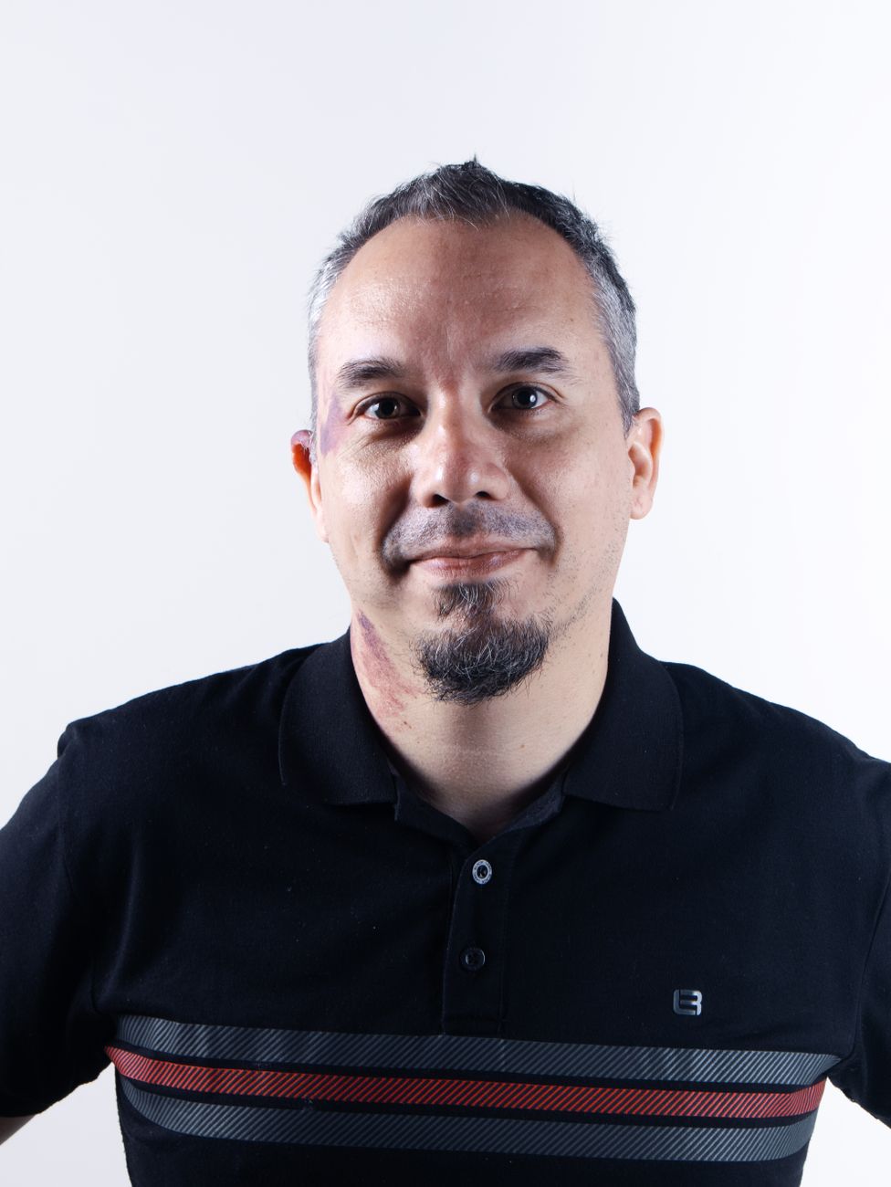Alex Escobar quebra o silêncio e atualiza estado de saúde após cirurgia: 'Já estive na escuridão'
