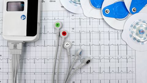 The salivary cortisol curve: what sampling across a day can and cannot capture