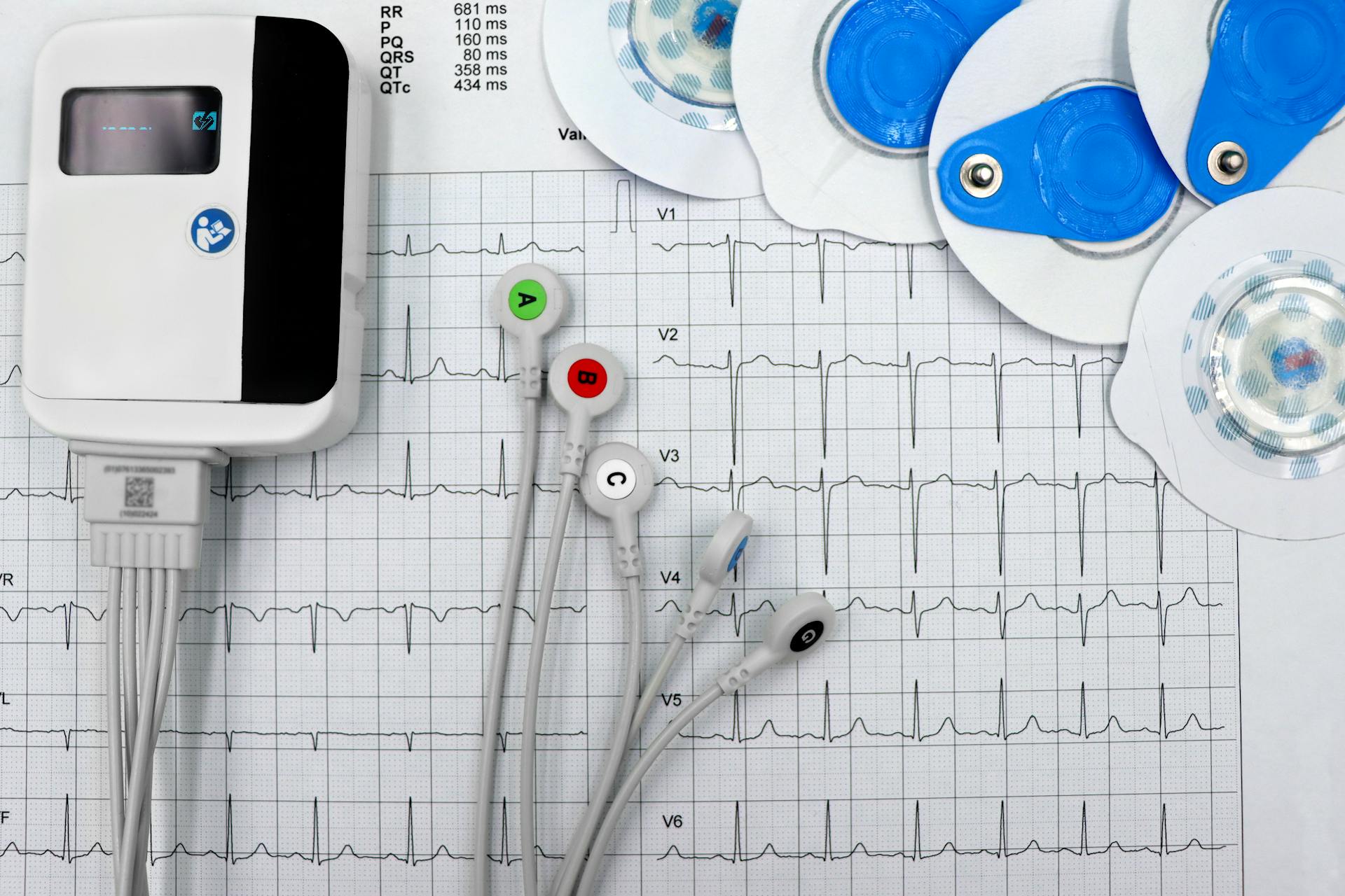 Holter Machine Display with a ECG Heart Exam and Electrolytes