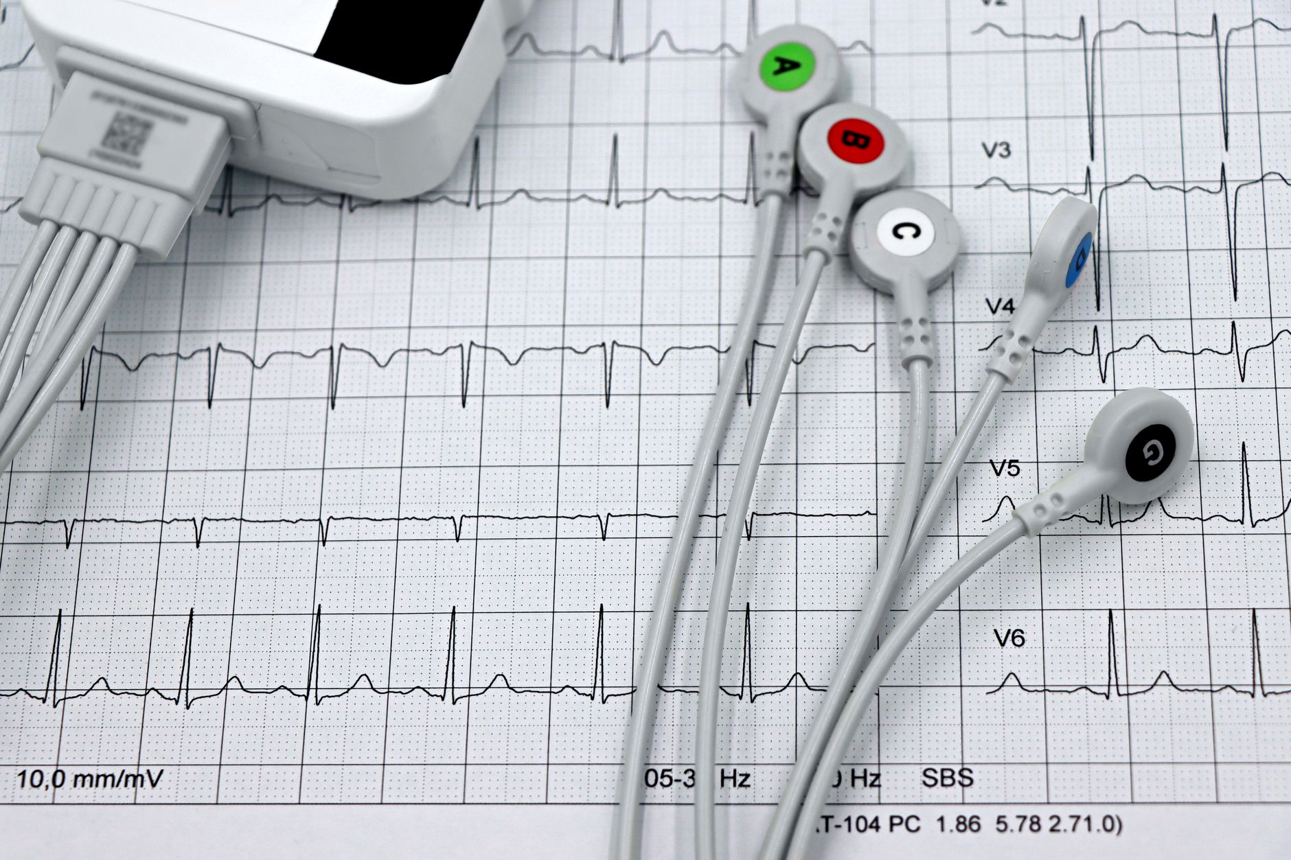 Best Heart Rate Monitors 2026: Chest Straps & Armband Picks