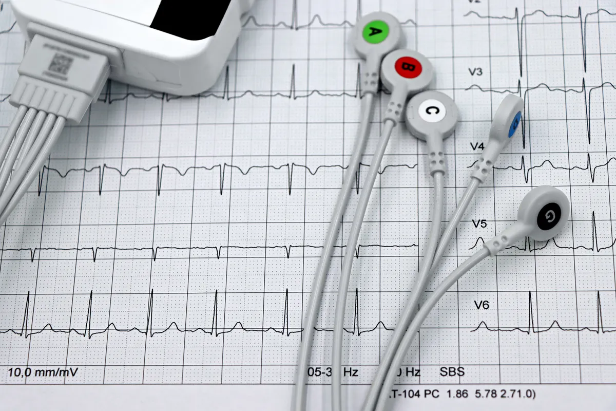 Hidden Cardiometabolic Risk in Lean and Obese Adults: What Phenogroups Reveal