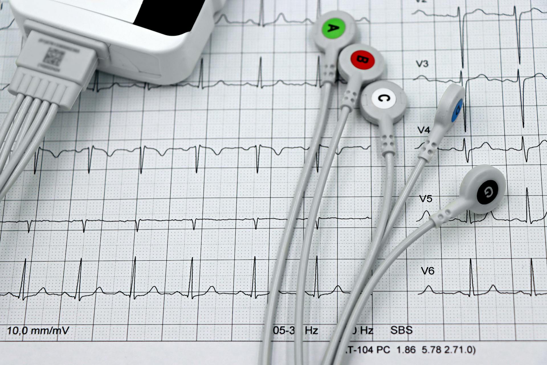 Holter Machine Display with a ECG Heart Exam and Electrolytes