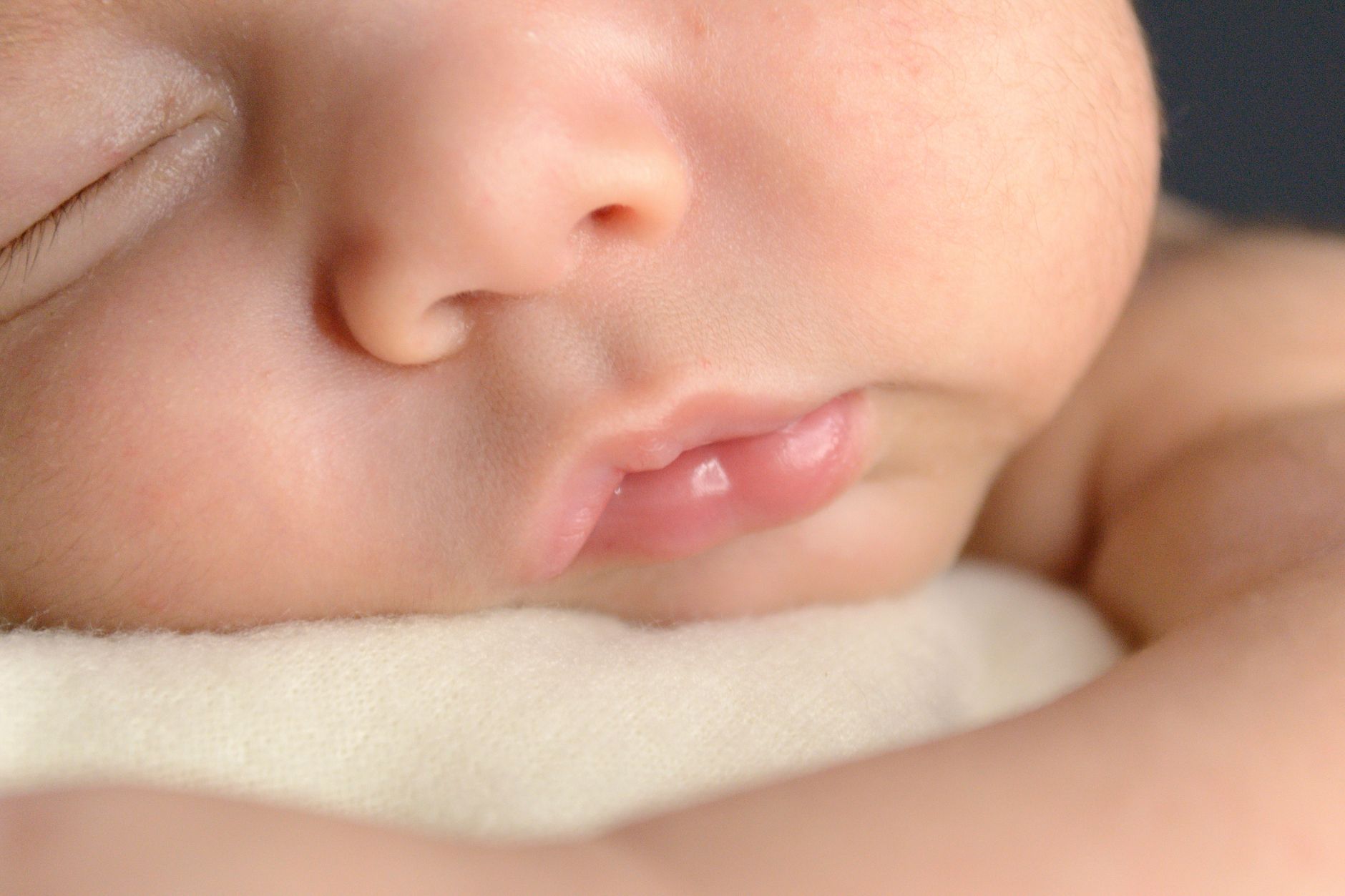Understanding Hereditary Angioedema (HAE): Symptoms, Causes, and Management