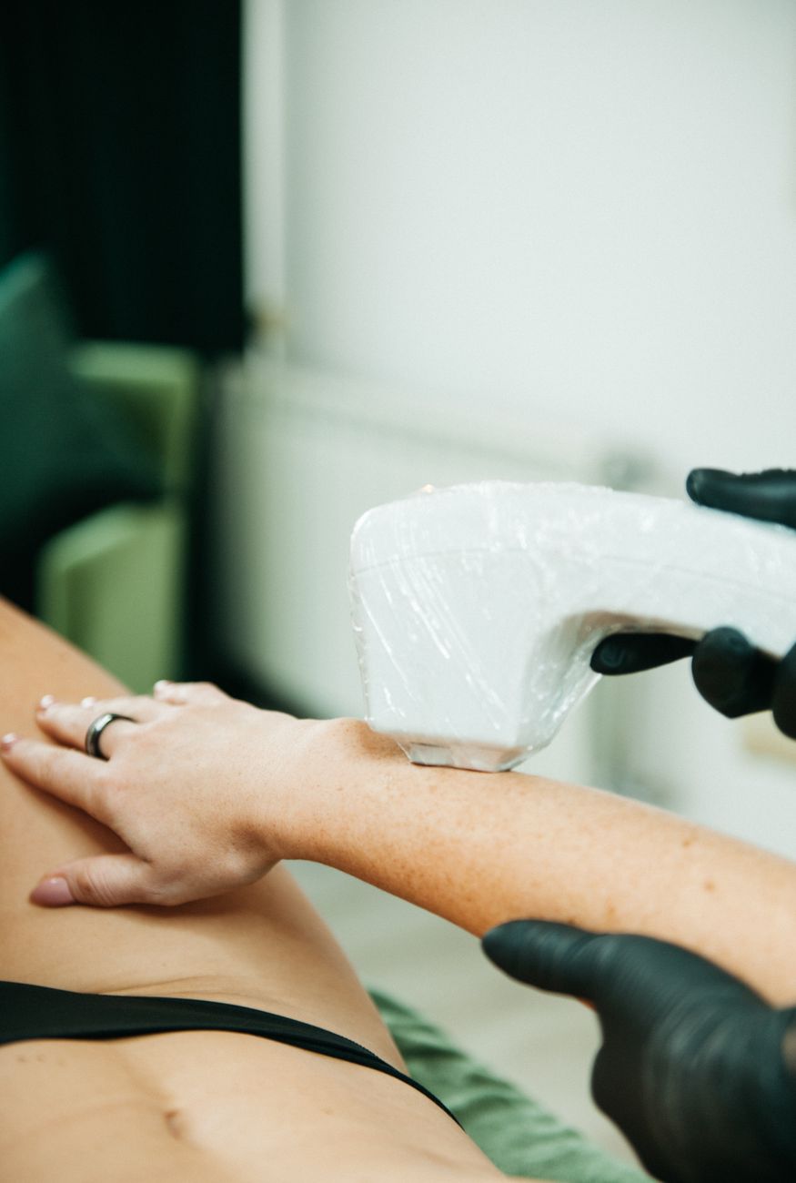 Before-and-after treatment photos—aesthetic clinic marketing Dubai visual results