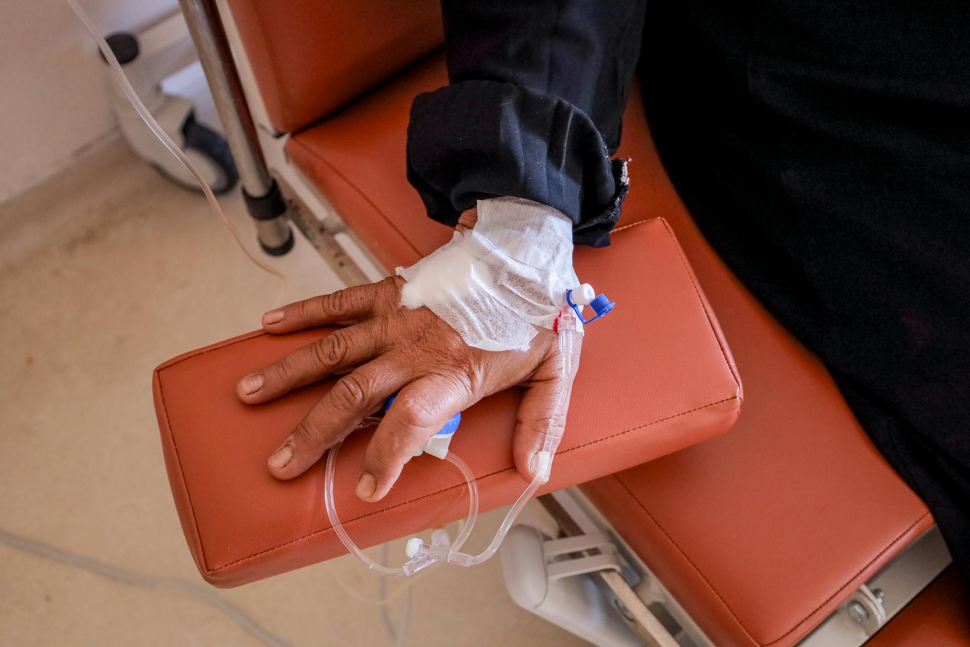 The hand of a woman suffering from breast cancer taking chemotherapy doses