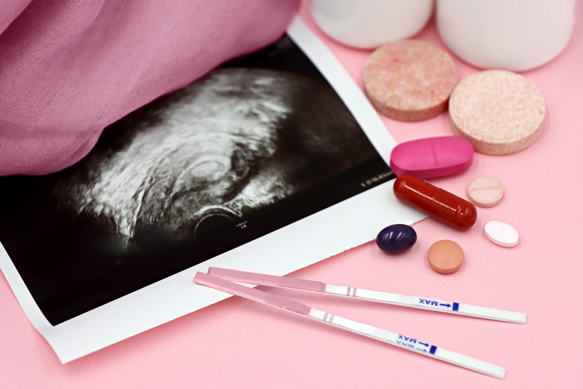 Ultrasound of the Uterus with Positive Pregnancy Tests and Hormonal Pills