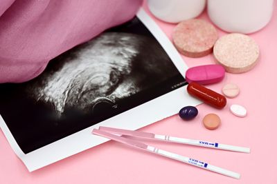 Low-dose aspirin for fertility and implantation support
