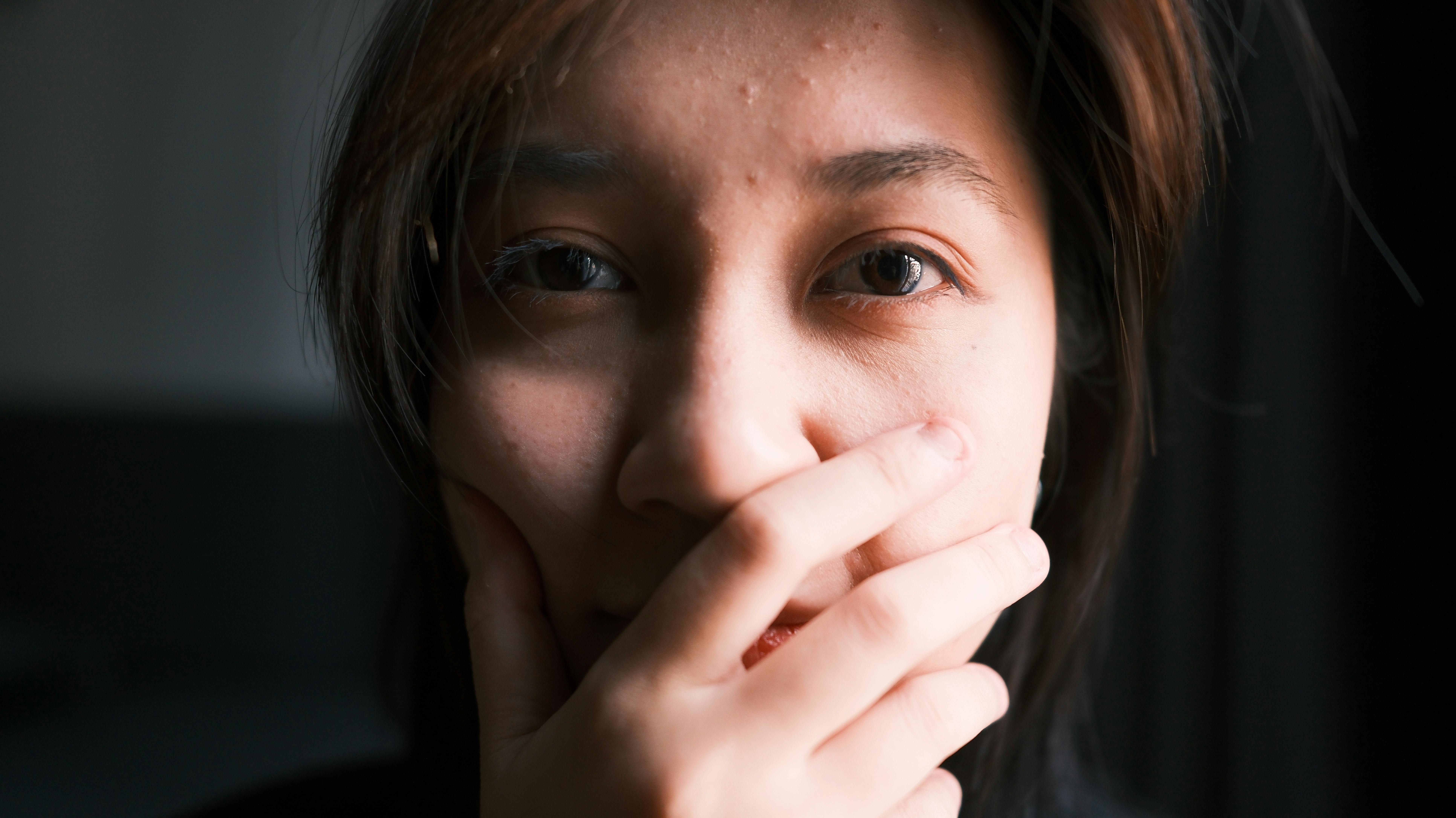 사춘기 여드름 없애는법 사춘기 여드름, 언제 병원에 가야 할까요?