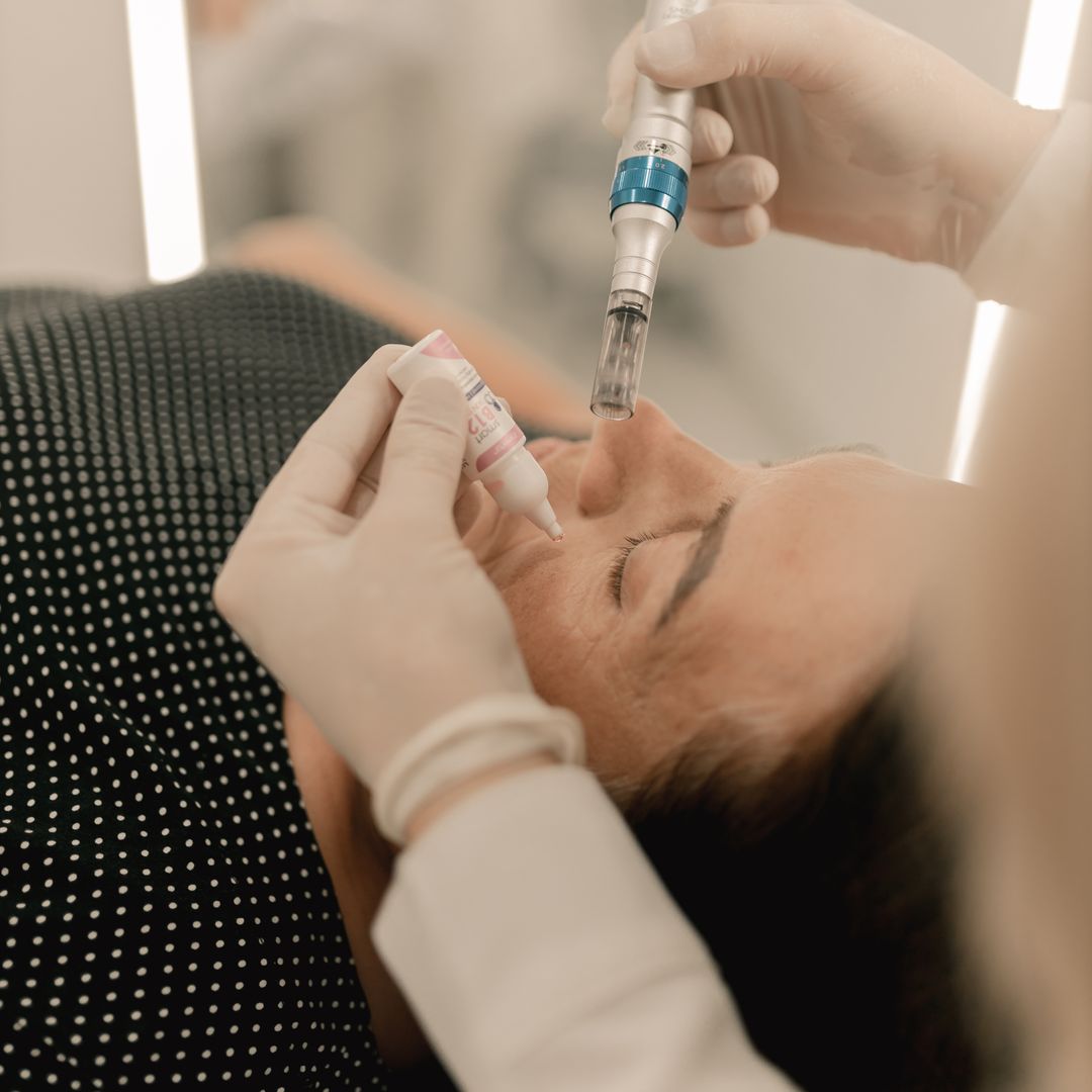 Clinical Standards and Logistics for Potenza RF Microneedling in Seoul