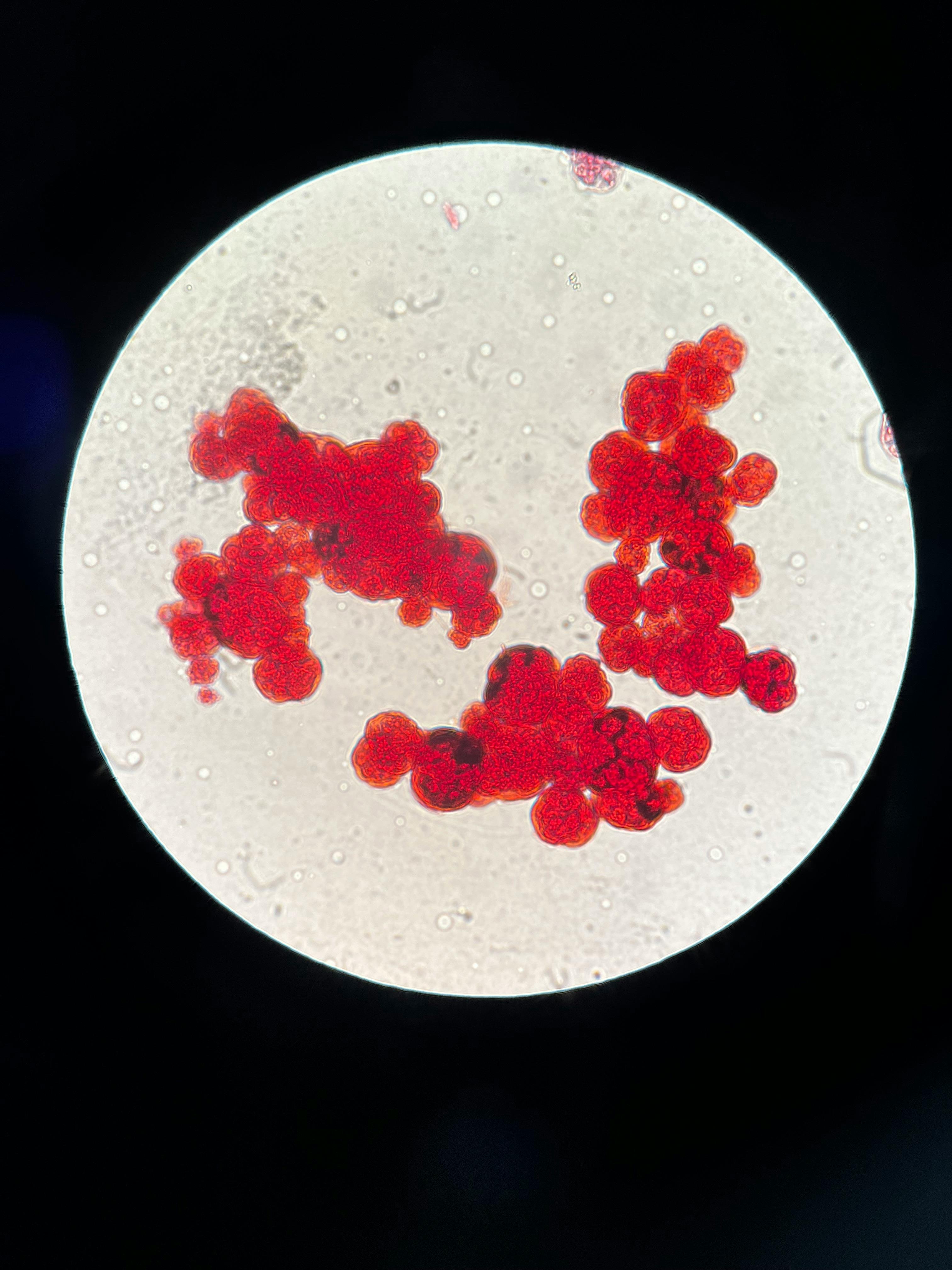 Close-up view of vibrant red microorganisms under a microscope, showcasing cellular detail.