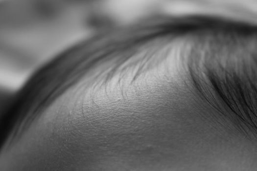 毛周角化症与暂时性鸡皮疙瘩的皮肤外观对比