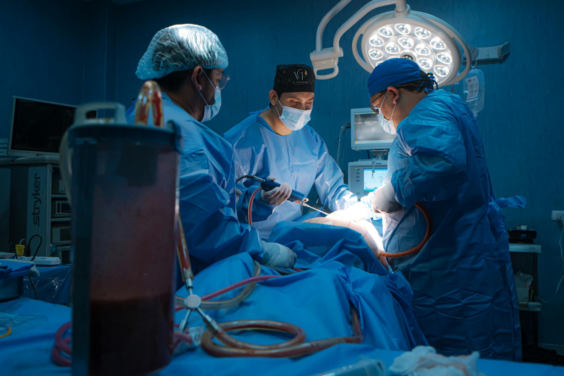 Team of surgeons performing a medical operation in an operating room in Lima, Peru.