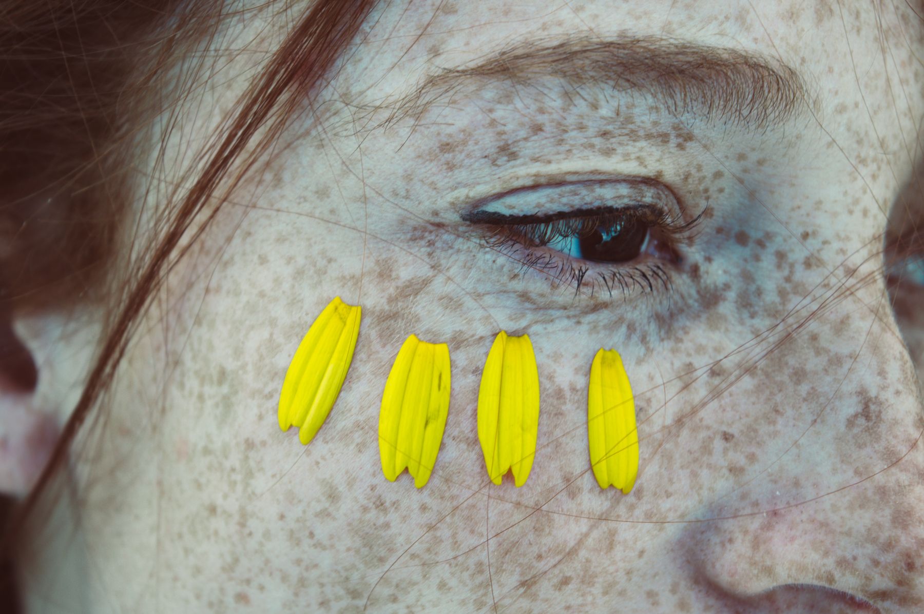 Close-up of freckled skin and an eye, lit by daylight